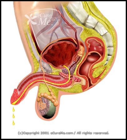 http://www.ecureme.com/atlas/data/dis_images/Gonorrhea550_ab.jpg